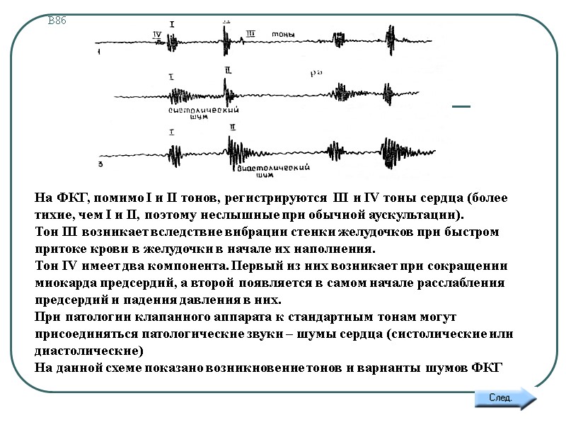 В8б  На ФКГ, помимо I и II тонов, регистрируются III и IV тоны